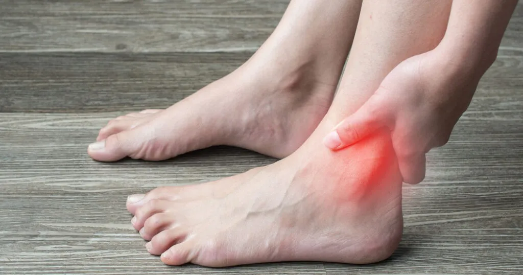 Chronic Ankle Pain