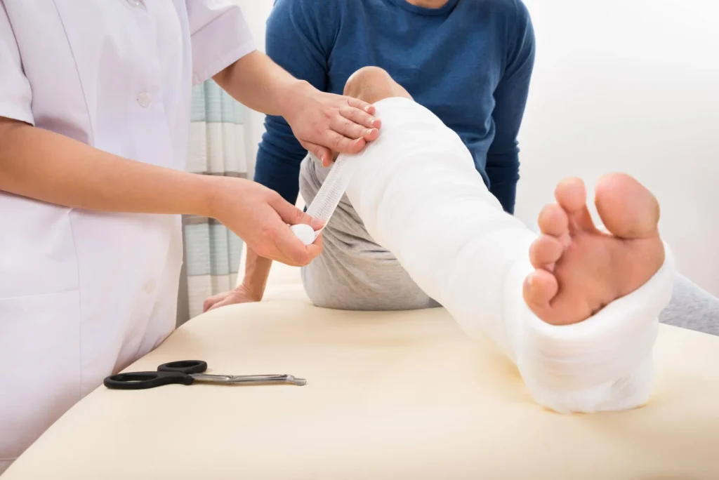 bone fractures