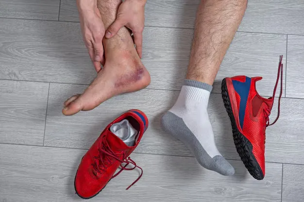 Sprain vs Fracture Foot: How to Tell the Difference