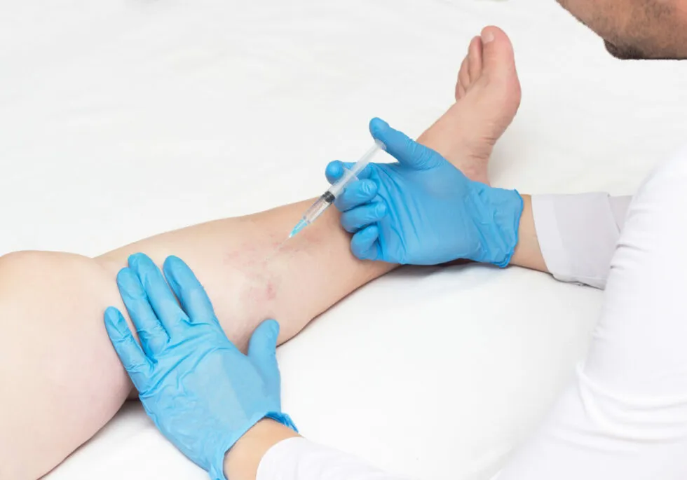 Vein Specialists