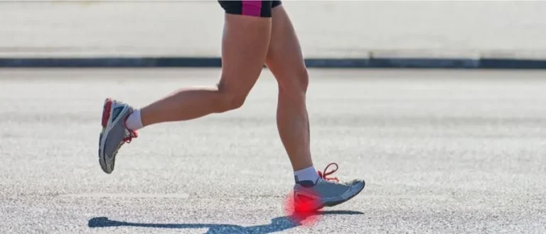 Plantar Fasciitis in Athletes