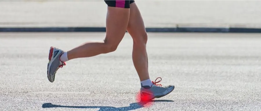 Plantar Fasciitis in Athletes