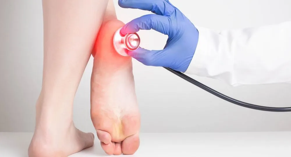 Foot Pain in Diabetics