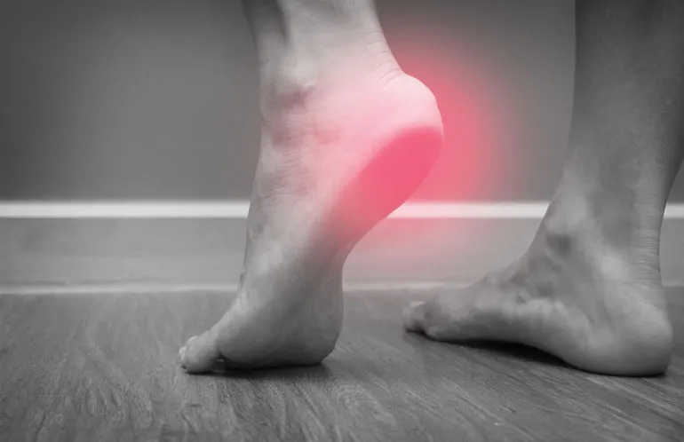 High Heel Foot Fracture