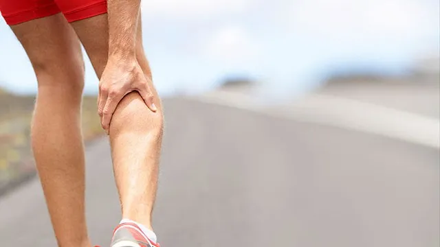 Running and Varicose Veins
