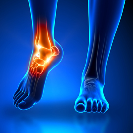 How Nutrition Affects Foot Pain and Inflammation