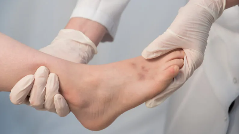 The Differences Between a Break and a Sprain