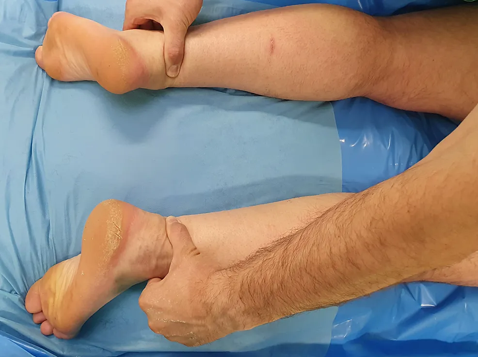 Achilles Tendon Injuries