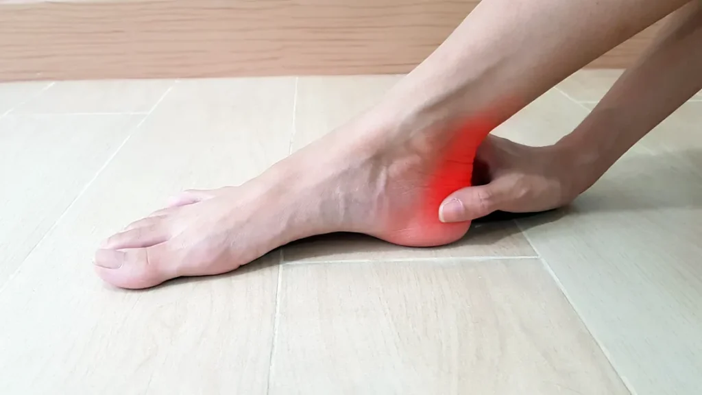 Leg Pain Caused by an Achilles Injury