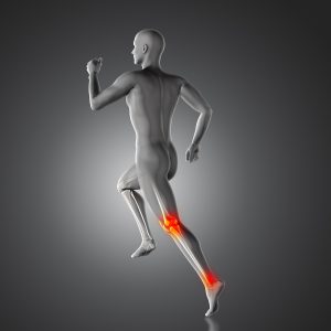Leg Pain Caused by an Achilles Injury? Ask Your Foot Doctor