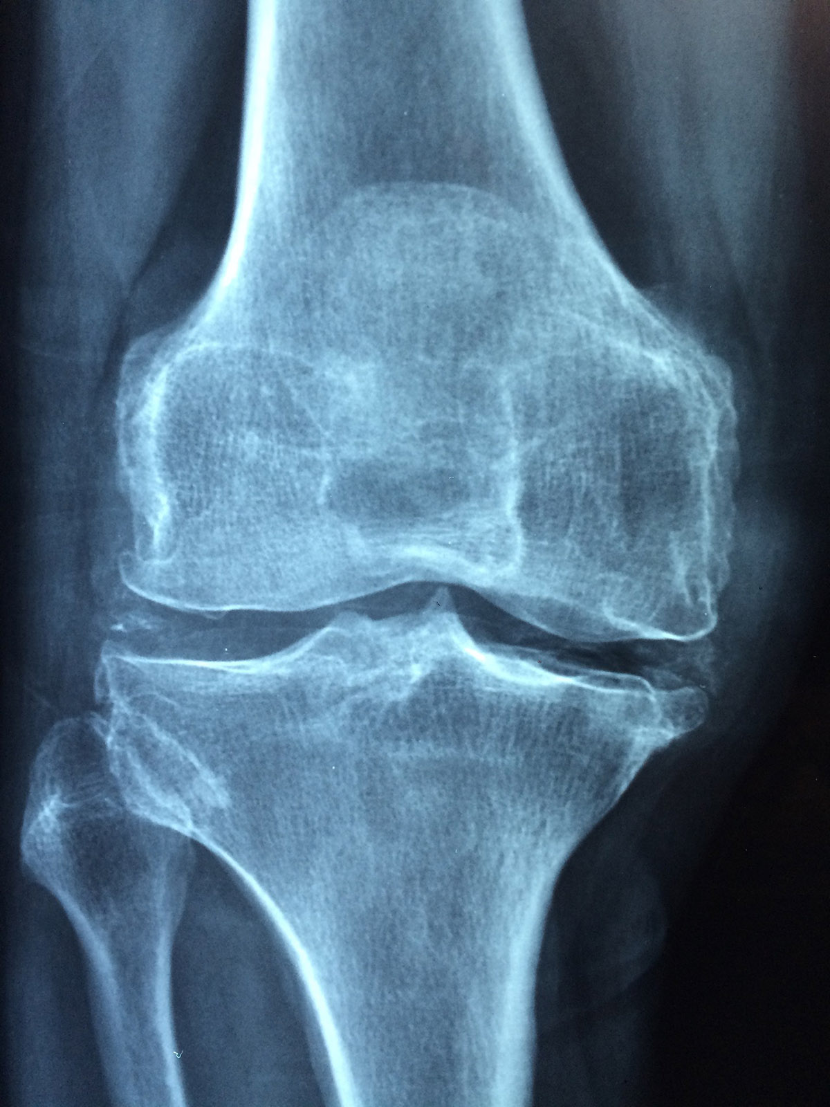 knee 1406964 1920 1