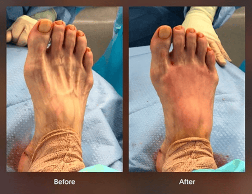Foot and Ankle Specialist in Boca Raton and Boynton Beach, FL