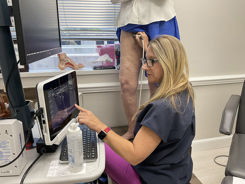 Spider Vein Treatment