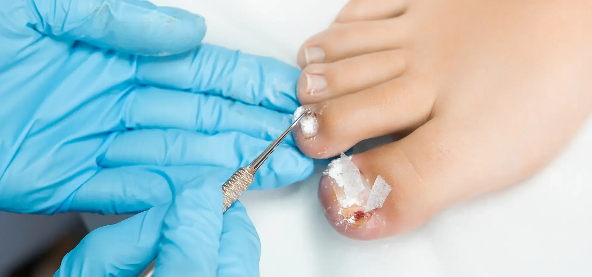 Benefits of a Sterile Pedicure in Boca Raton