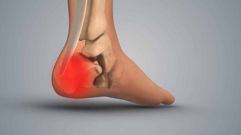 The Silent Cushion: How Your Foot's Fat Pad Holds the Key to Pain-Free Movement and Longevity