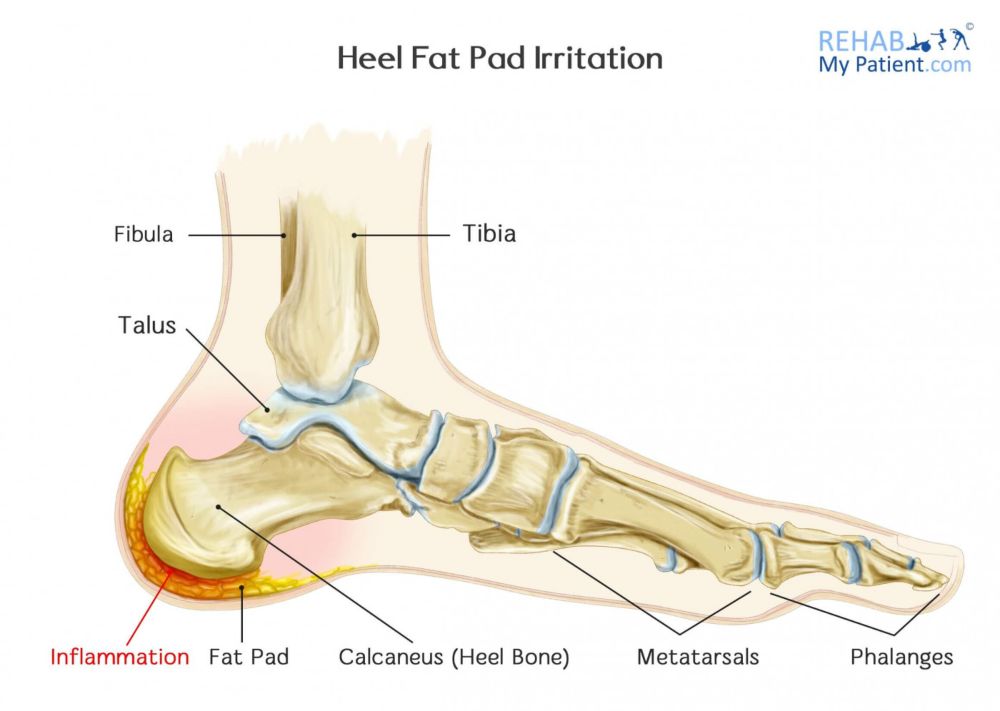 heel fat