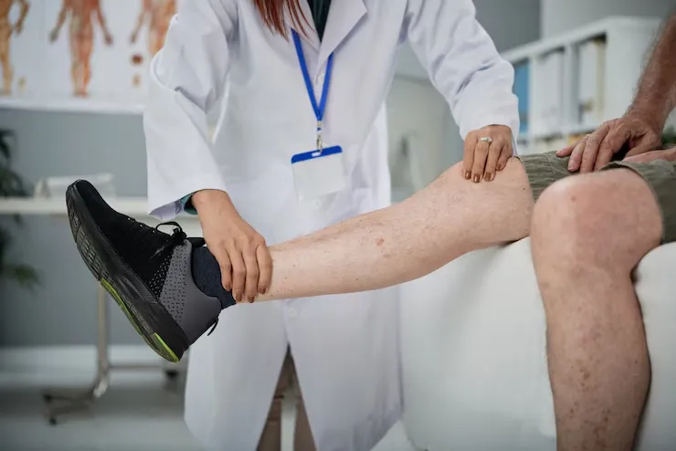 What Causes Spider Veins and How to Treat Them