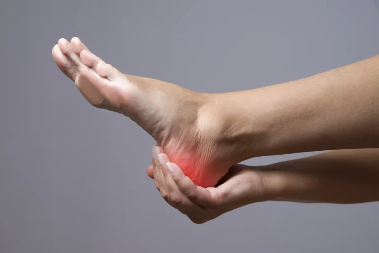 Heel Spur vs Plantar Fasciitis: Key Differences