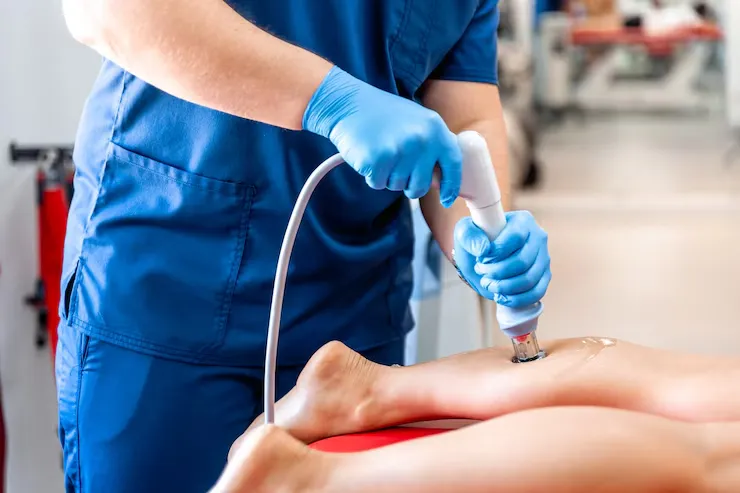 When to Worry About Varicose Veins: Doctor Tips