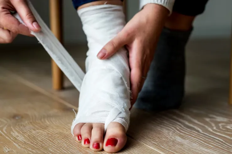 How to Tell If Your Foot Is Fractured: Full Guide